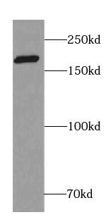 RIMS1 Antibody - BSA Free