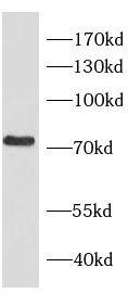 RHOT2 Antibody - BSA Free