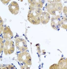 RhoB Antibody - BSA Free