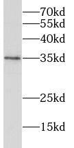 RHBDL2 Antibody - BSA Free
