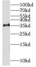 RHBDD1 Antibody - BSA Free