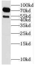 RGS9 Antibody - BSA Free