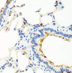 RGS5 Antibody - BSA Free