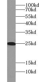 RGS2 Antibody - BSA Free