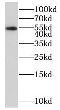 RGS11 Antibody - BSA Free