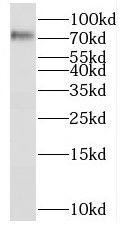 RFX3 Antibody - BSA Free