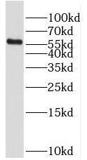 RFTN2 Antibody - BSA Free