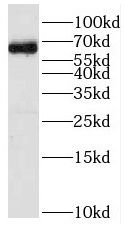 RFTN1 Antibody - BSA Free