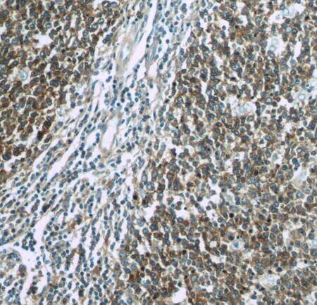 RFTN1 Antibody - BSA Free