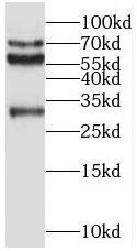 REPS2 Antibody - BSA Free