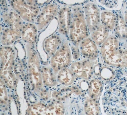 RECQL4 Antibody - BSA Free