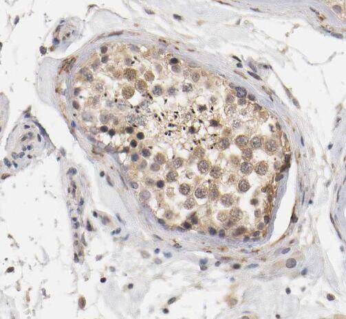 RDM1 Antibody - BSA Free