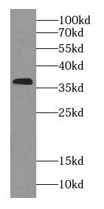 RDH14 Antibody - BSA Free