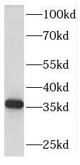 RDH13 Antibody - BSA Free