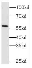 RCOR2 Antibody - BSA Free