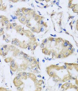 RCN2 Antibody - BSA Free