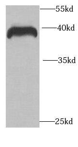 RCN2 Antibody - BSA Free