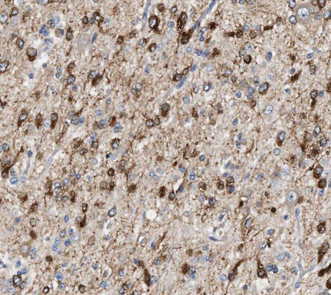 RCAN2 Antibody - BSA Free