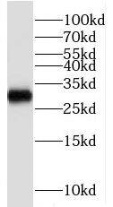 RNA binding motif protein, X-linked 2 Antibody - BSA Free