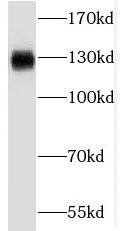 RBM6 Antibody - BSA Free