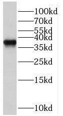 RBM4B Antibody - BSA Free