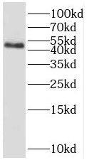 RBM41 Antibody - BSA Free