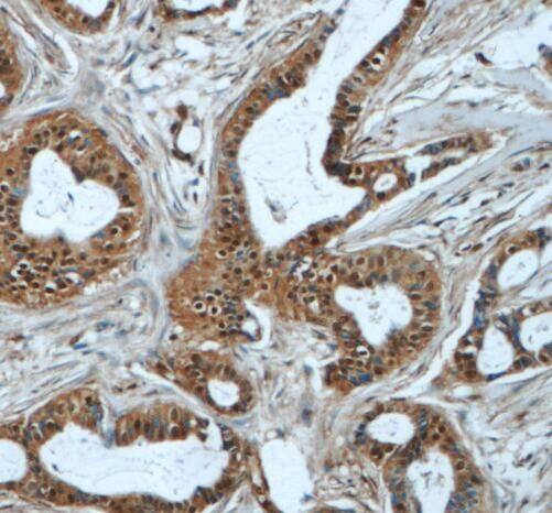 RBM25 Antibody - BSA Free