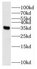 RBM11 Antibody - BSA Free