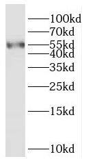 RASGEF1A Antibody - BSA Free