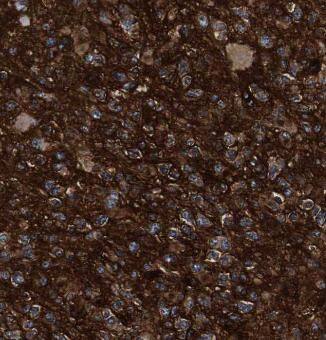 RAP1GDS1 Antibody - BSA Free