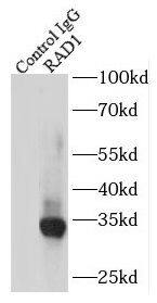 Rad1 Antibody - BSA Free