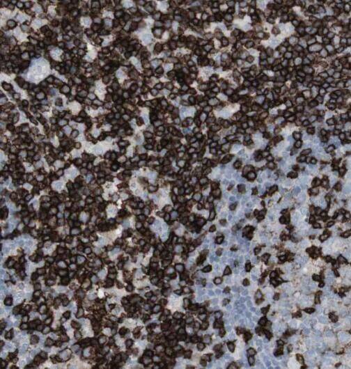 Rad1 Antibody - BSA Free