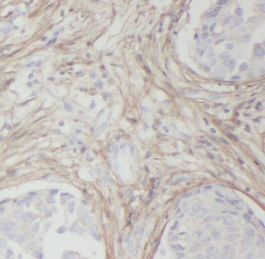 RABL3 Antibody - BSA Free