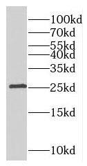 RABL3 Antibody - BSA Free