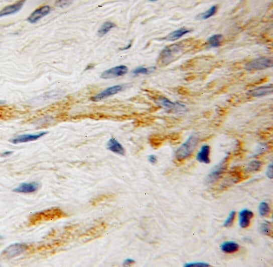 Rabex5 Antibody - BSA Free