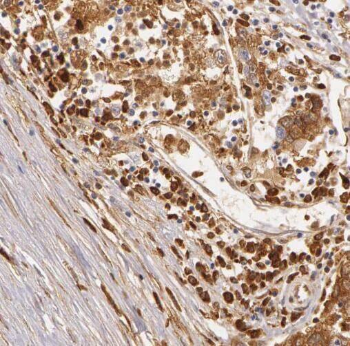 RABGAP1L Antibody - BSA Free