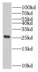 RAB7B Antibody - BSA Free