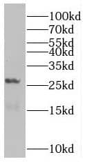 Rab5b Antibody - BSA Free