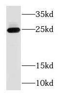 RAB3B Antibody - BSA Free