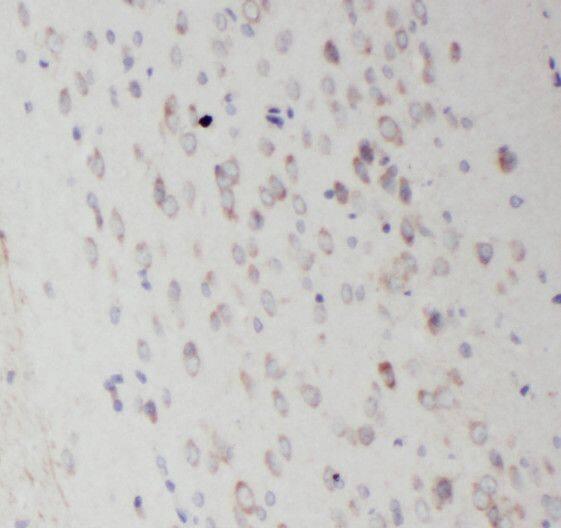 RAB35 Antibody - BSA Free