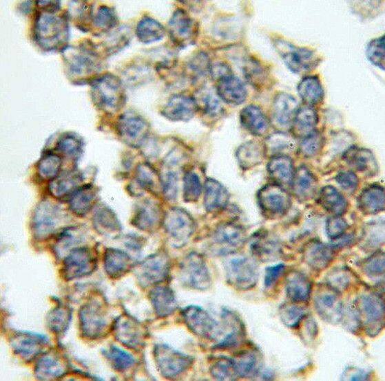 RAB33A Antibody - BSA Free