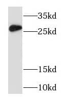 RAB33A Antibody - BSA Free