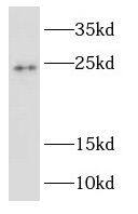 RAB2B Antibody - BSA Free
