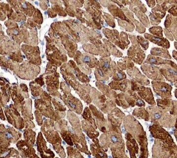 RAB1B Antibody - BSA Free