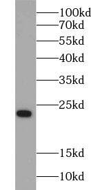 RAB1B Antibody - BSA Free