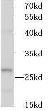 RAB12 Antibody - BSA Free