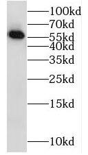 RAB11FIP2 Antibody - BSA Free