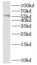 QRSL Antibody - BSA Free
