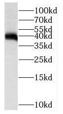 PTPN7 Antibody - BSA Free