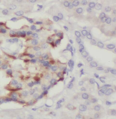 PTPN4 Antibody - BSA Free